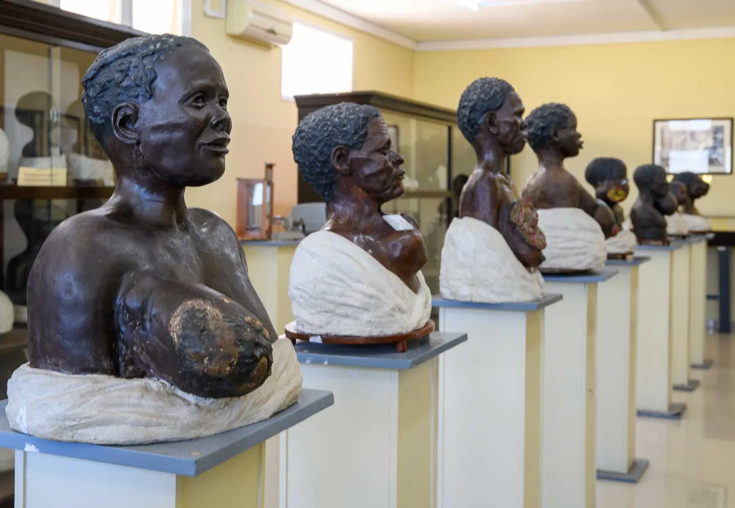 Museum of the Pathological Anatomy Service at Maputo Central Hospital